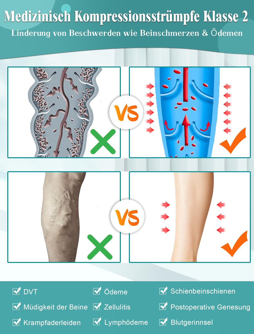 20-30 mmHg Medical Compression Stockings Class 2 for Varicose Veins – Unisex